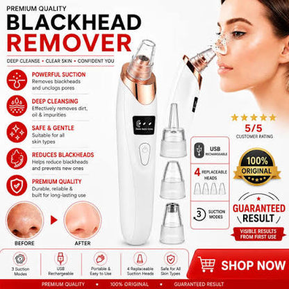 Blackhead Remover features and benefits infographic